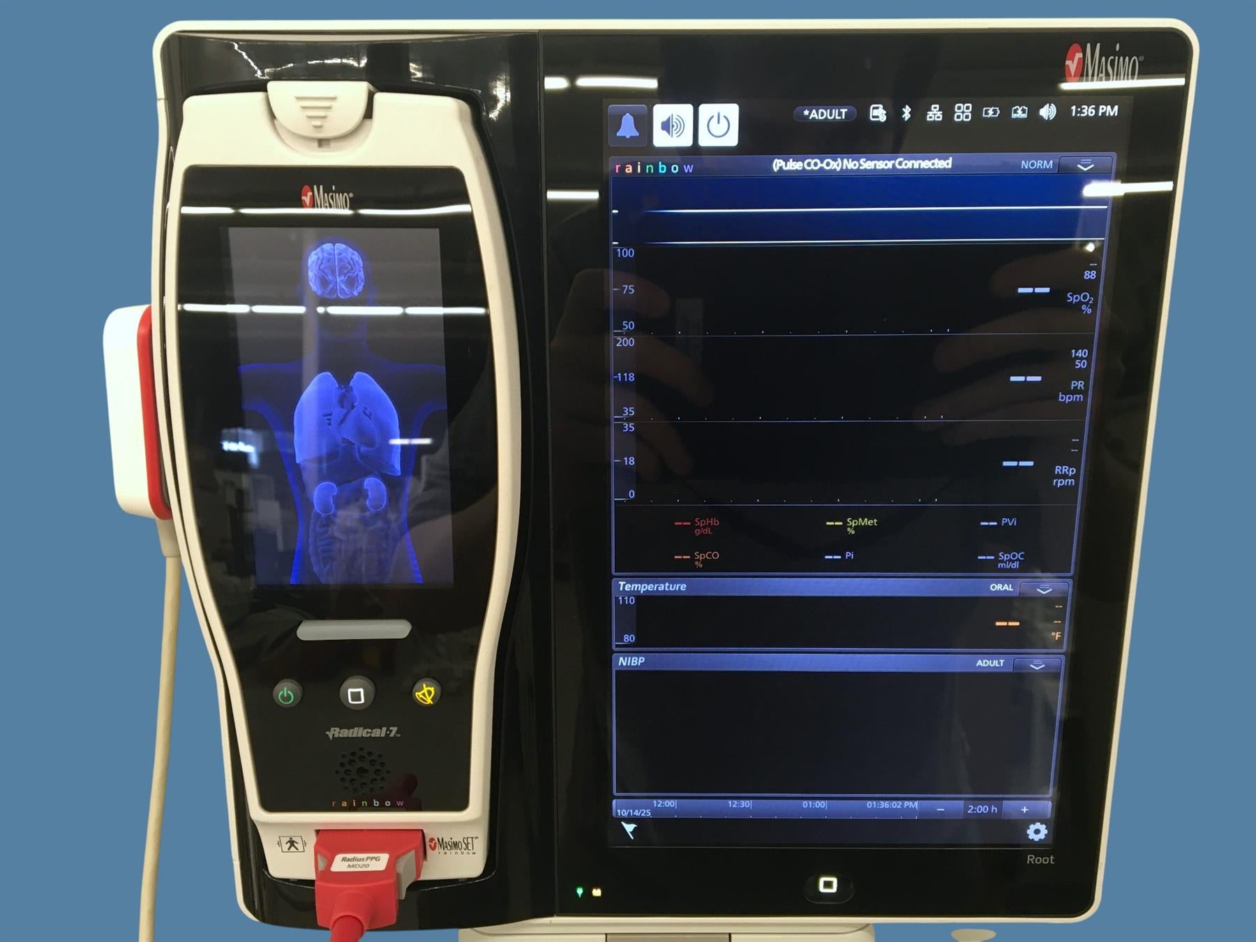 Masimo ROOT Patient Monitor w/ Radical-7 Oximeter & Radius PPG w/ Cart, Cables