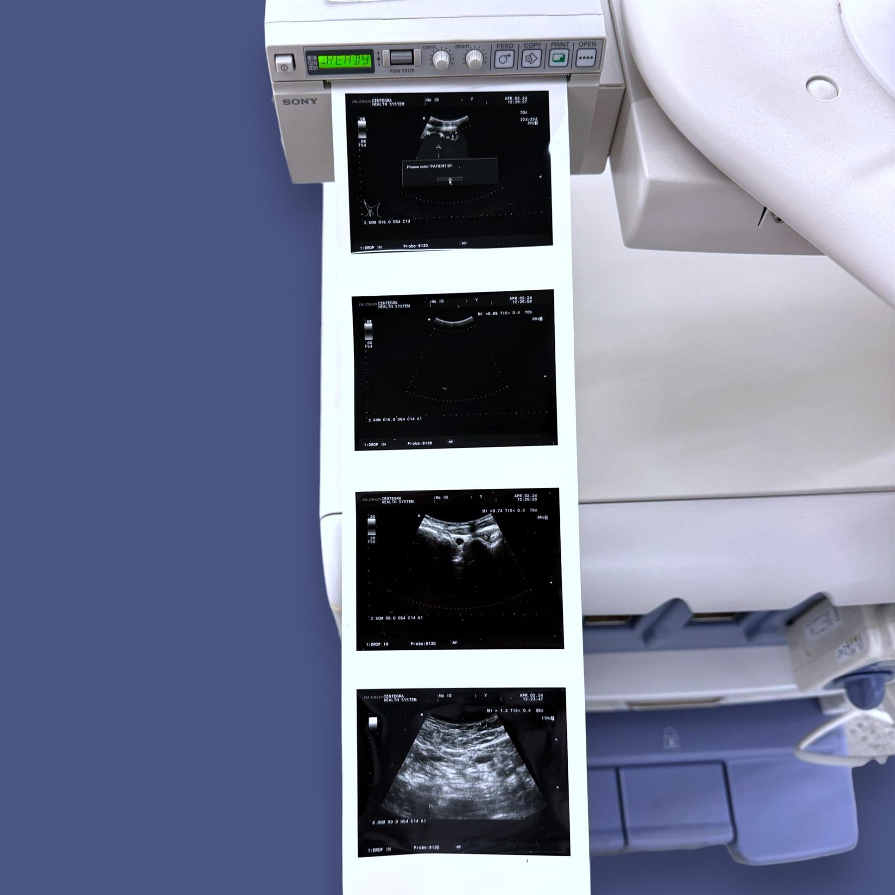 Hitachi Aloka SSD- a10 Prosound Ultrasound System w/ Aloka 9130 Probe