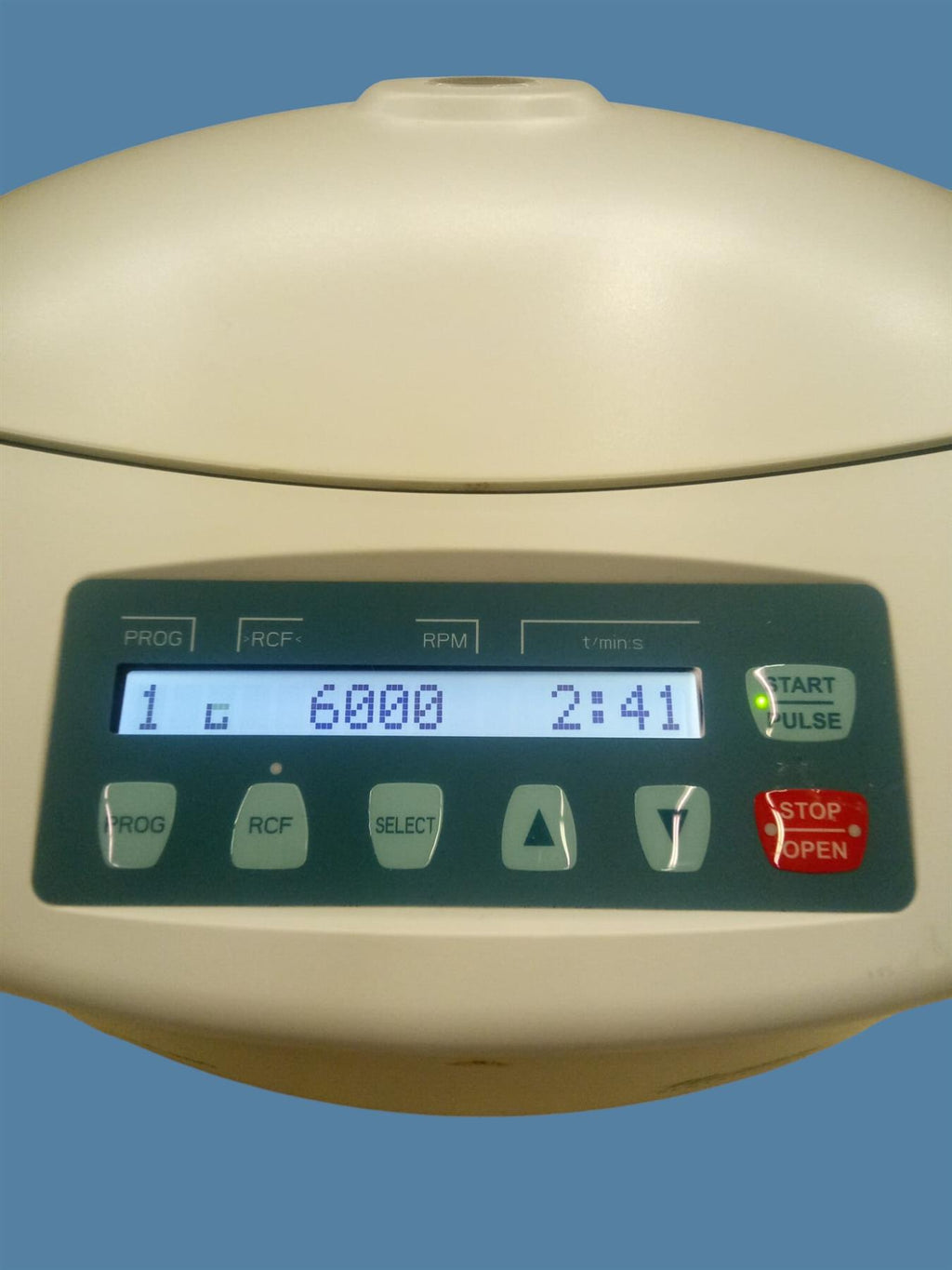 Hettich EBA 280S Serology Centrifuge w/ 6-Place Swing-Out Rotor