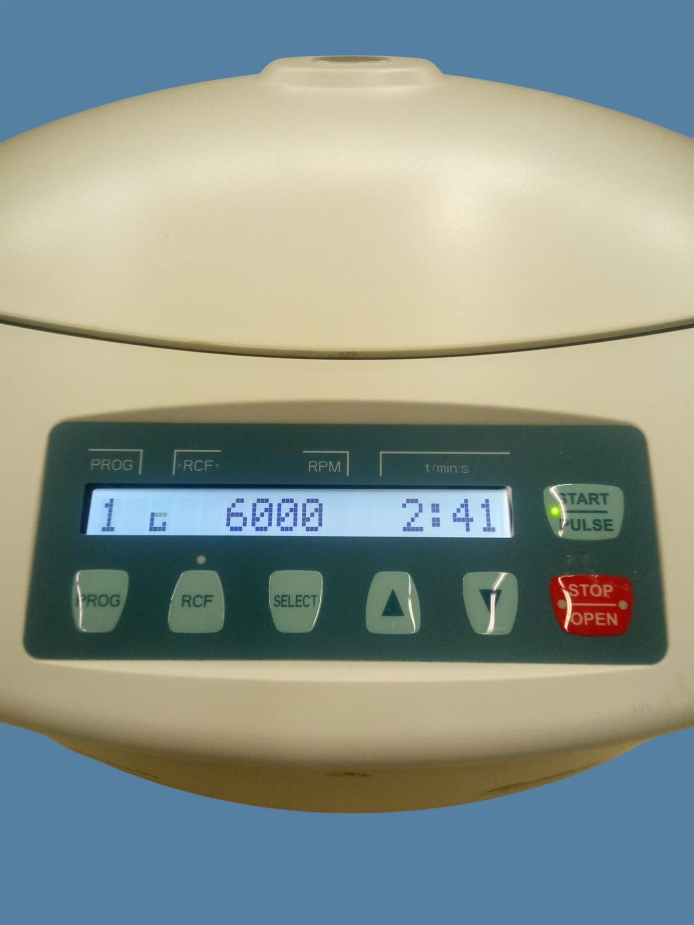 Hettich EBA 280S Serology Centrifuge w/ 6-Place Swing-Out Rotor