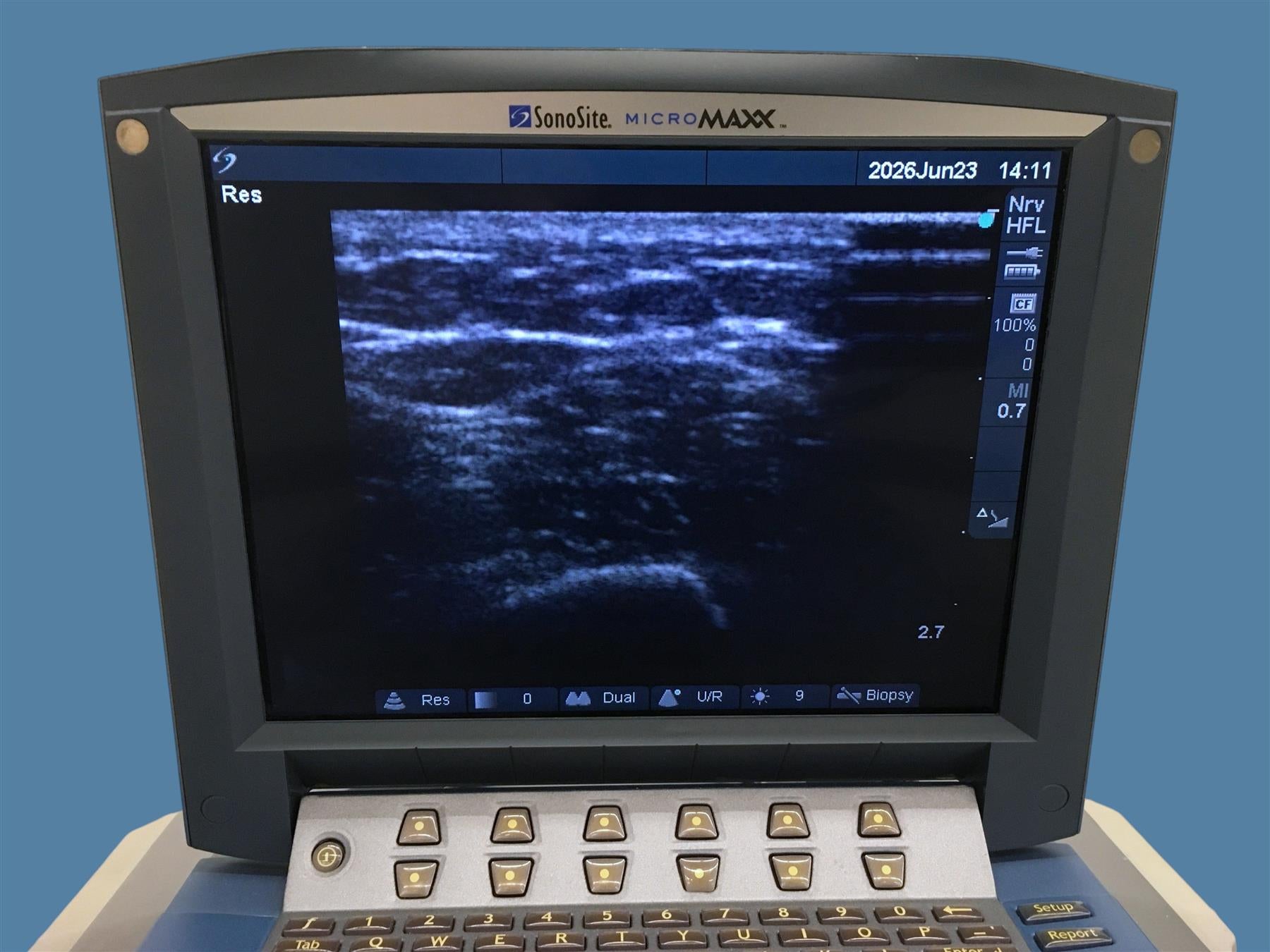 FujiFilm SonoSite MicroMaxx Ultrasound System w/ HFL38/13-6 Probe & Sony Printer