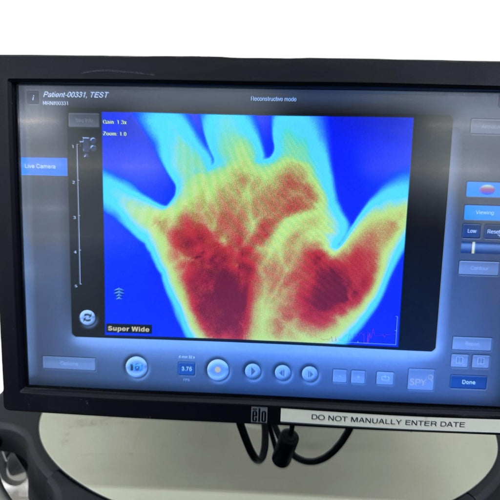 2013 Model Novadaq SPY Elite LC3000 Fluorescence Imaging System