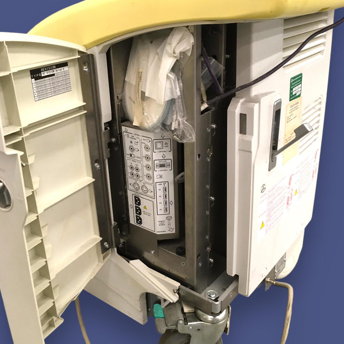 Hitachi Aloka High Vision Avius Breast Ultrasound
