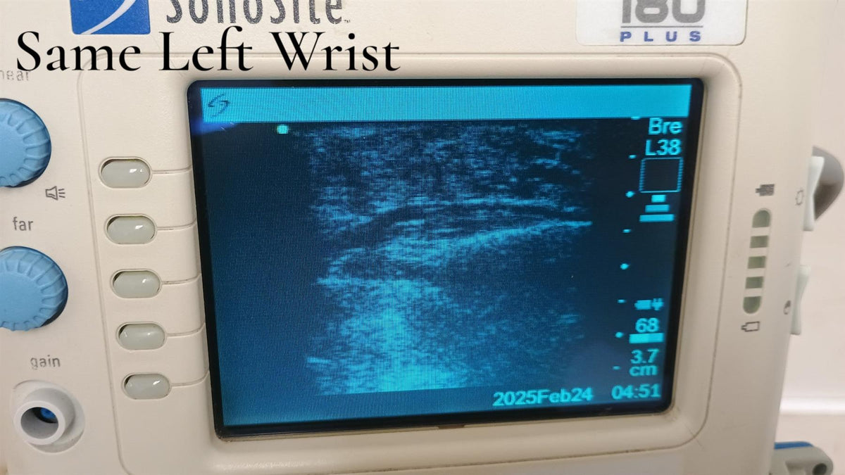 SonoSite 180 Plus Portable Ultrasound System w/ L38/10-5 Probe & Power Cart READ