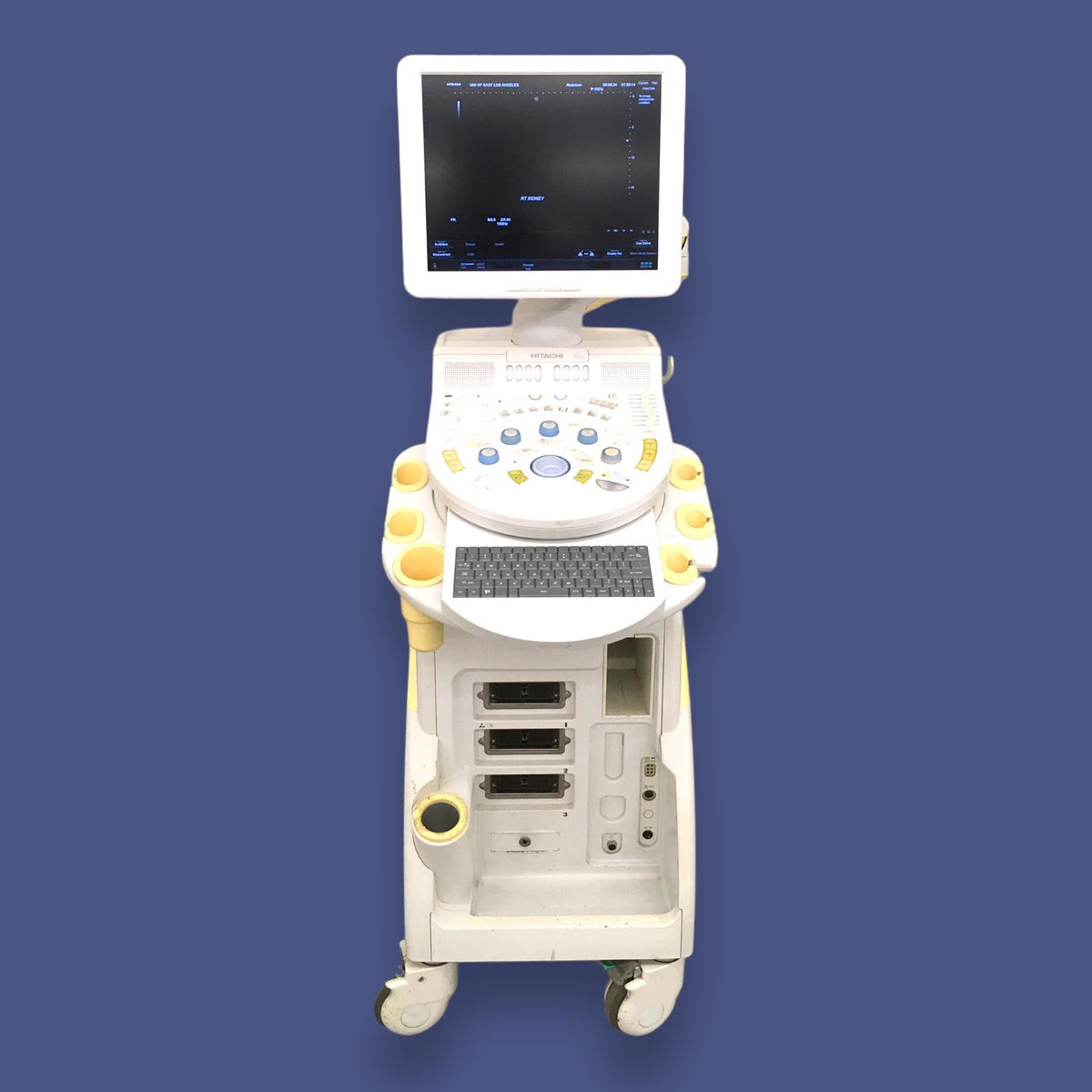 Hitachi Aloka High Vision Avius Breast Ultrasound