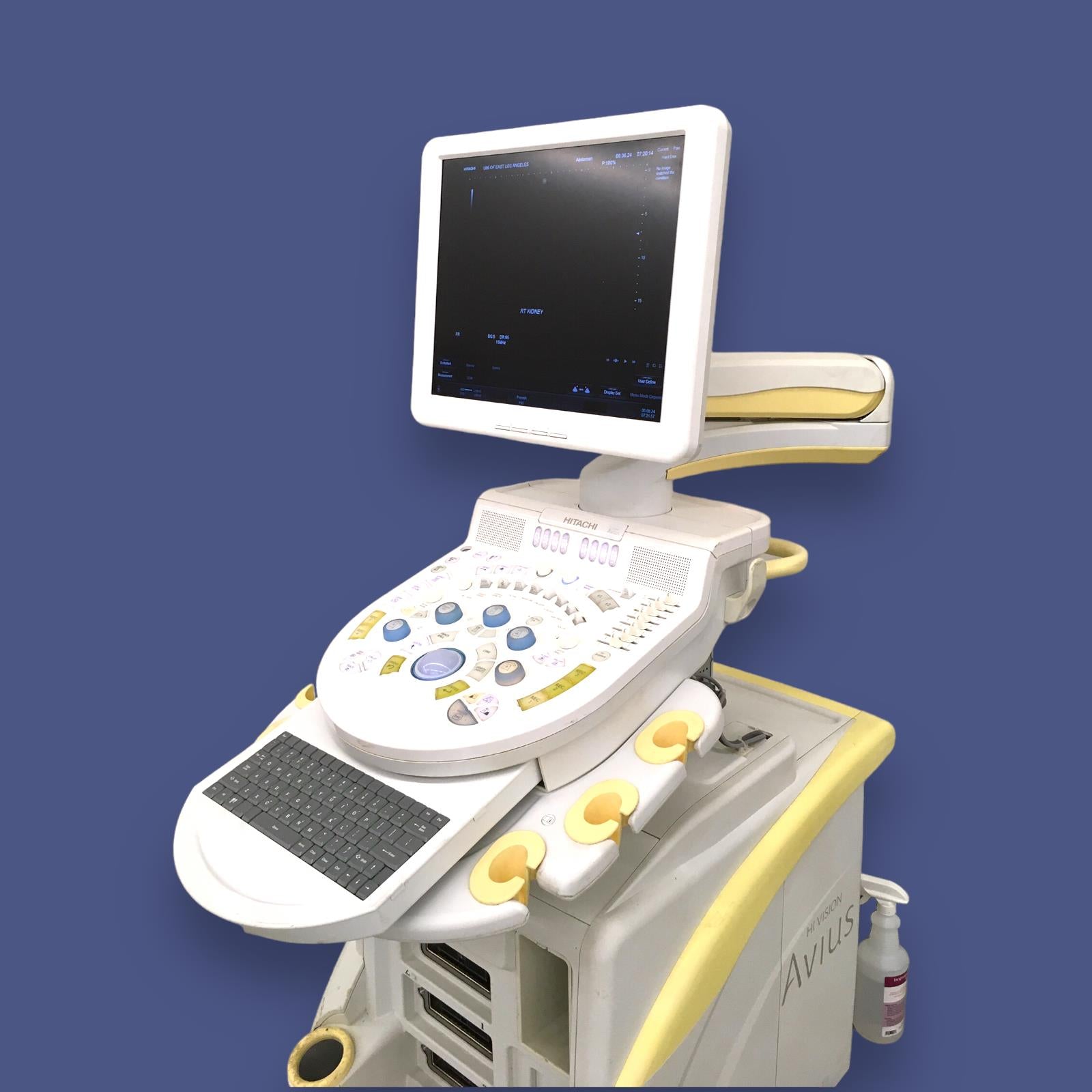 Hitachi Aloka High Vision Avius Breast Ultrasound