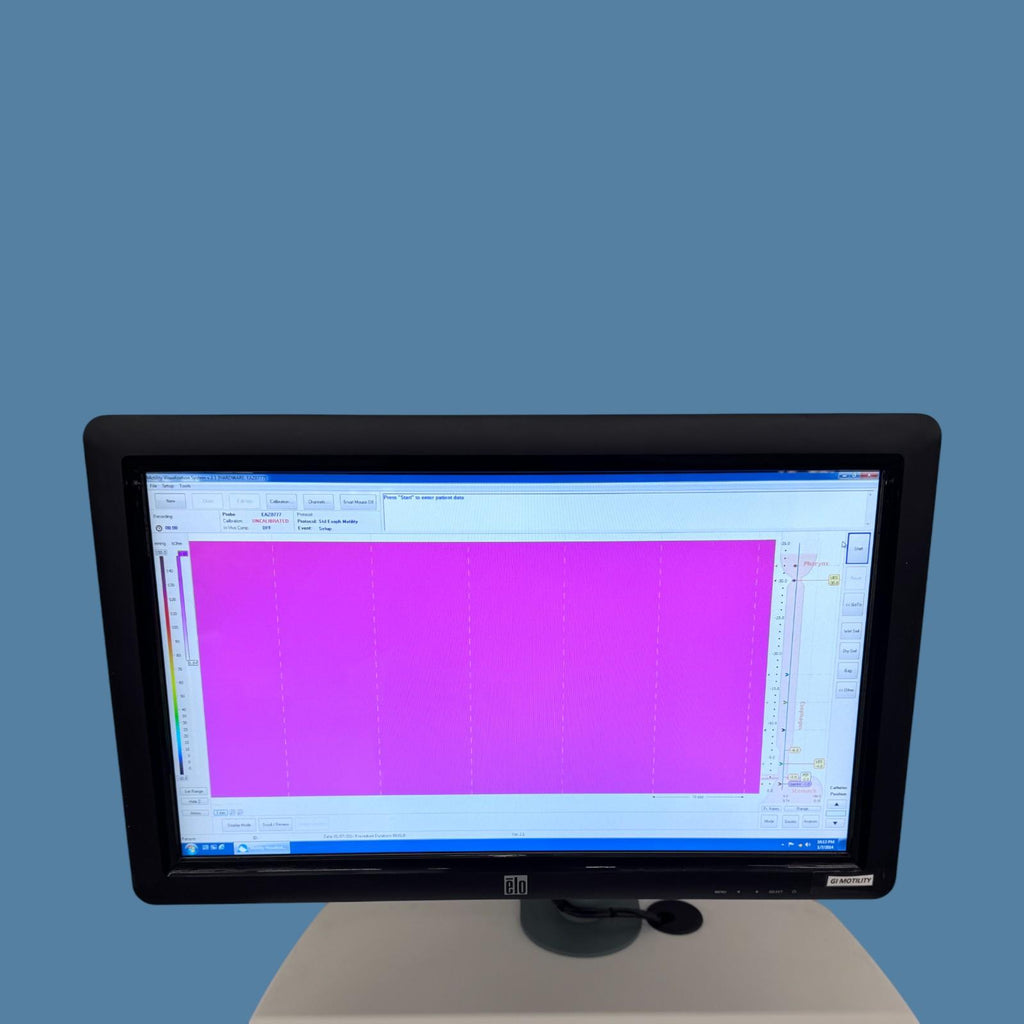 Given Imaging Glen Imaging ManoScan System