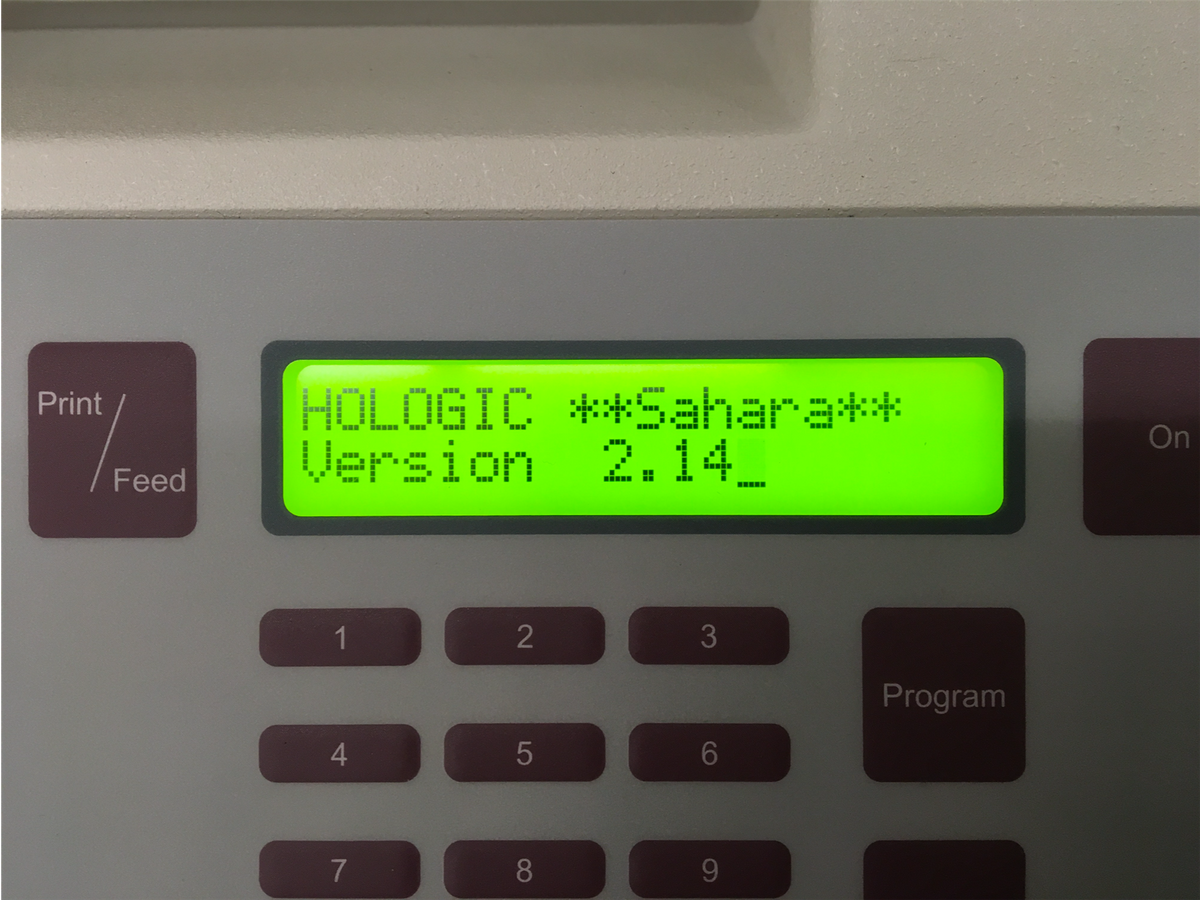 Hologic Inc. Sahara Clinical Bone Sonometer, Error Code 21, POST Fail (2011)