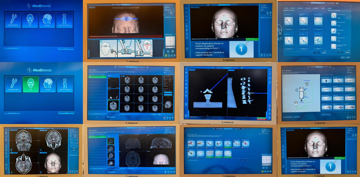 Medtronic StealthStation S7 Treatment Guidance System/Navigation System