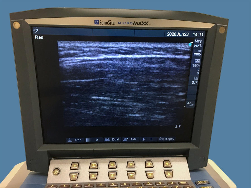 FujiFilm SonoSite MicroMaxx Ultrasound System w/ HFL38/13-6 Probe & Sony Printer