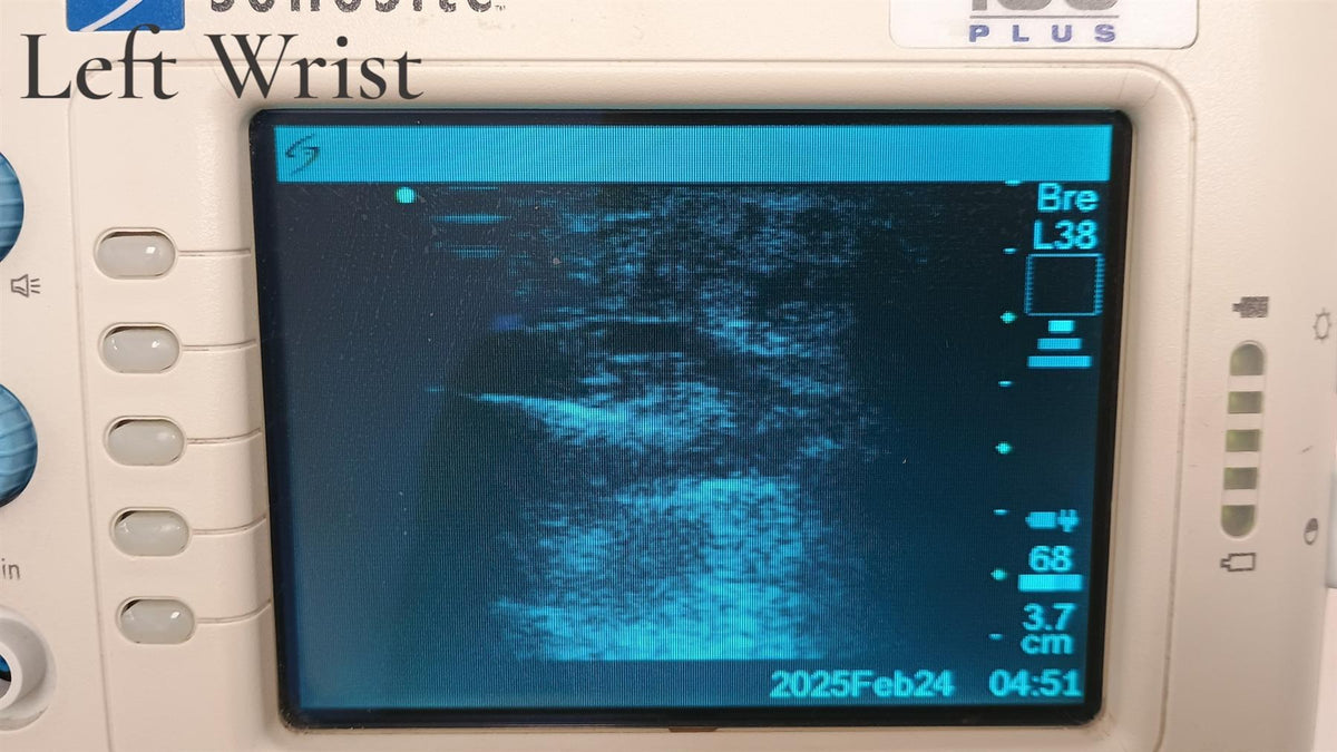 SonoSite 180 Plus Portable Ultrasound System w/ L38/10-5 Probe & Power Cart READ