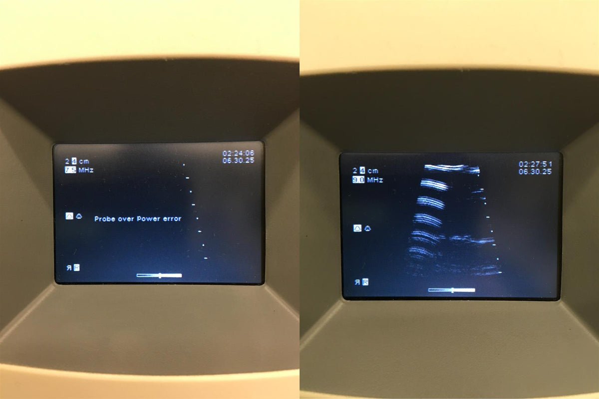 Bard Site-Rite IV Ultrasound System w/ 2 Probes, 2 Batteries & Charger (READ)