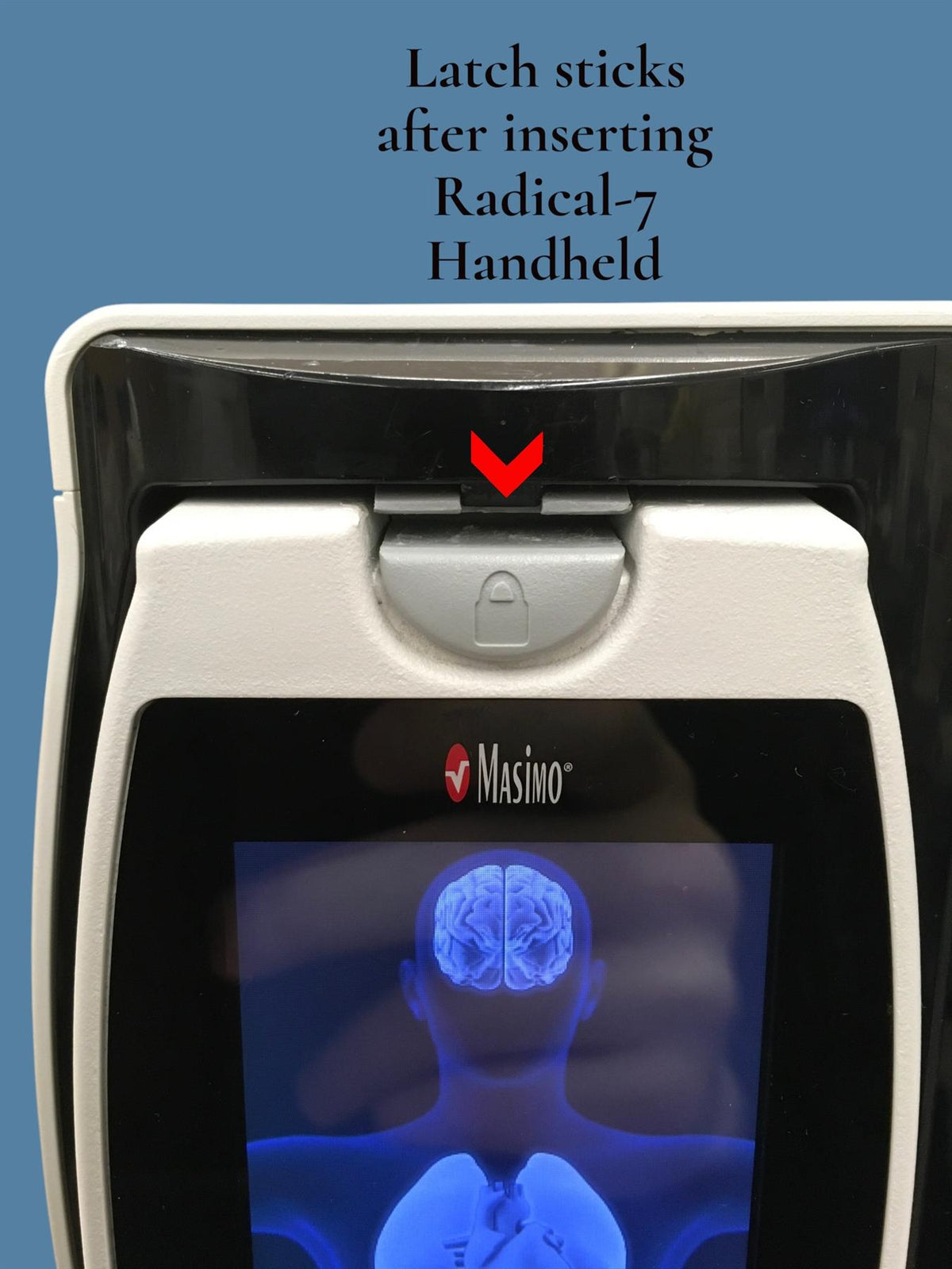 Masimo RDS7A Root Patient Monitor w/ Radical-7 Handheld Pulse Oximeter