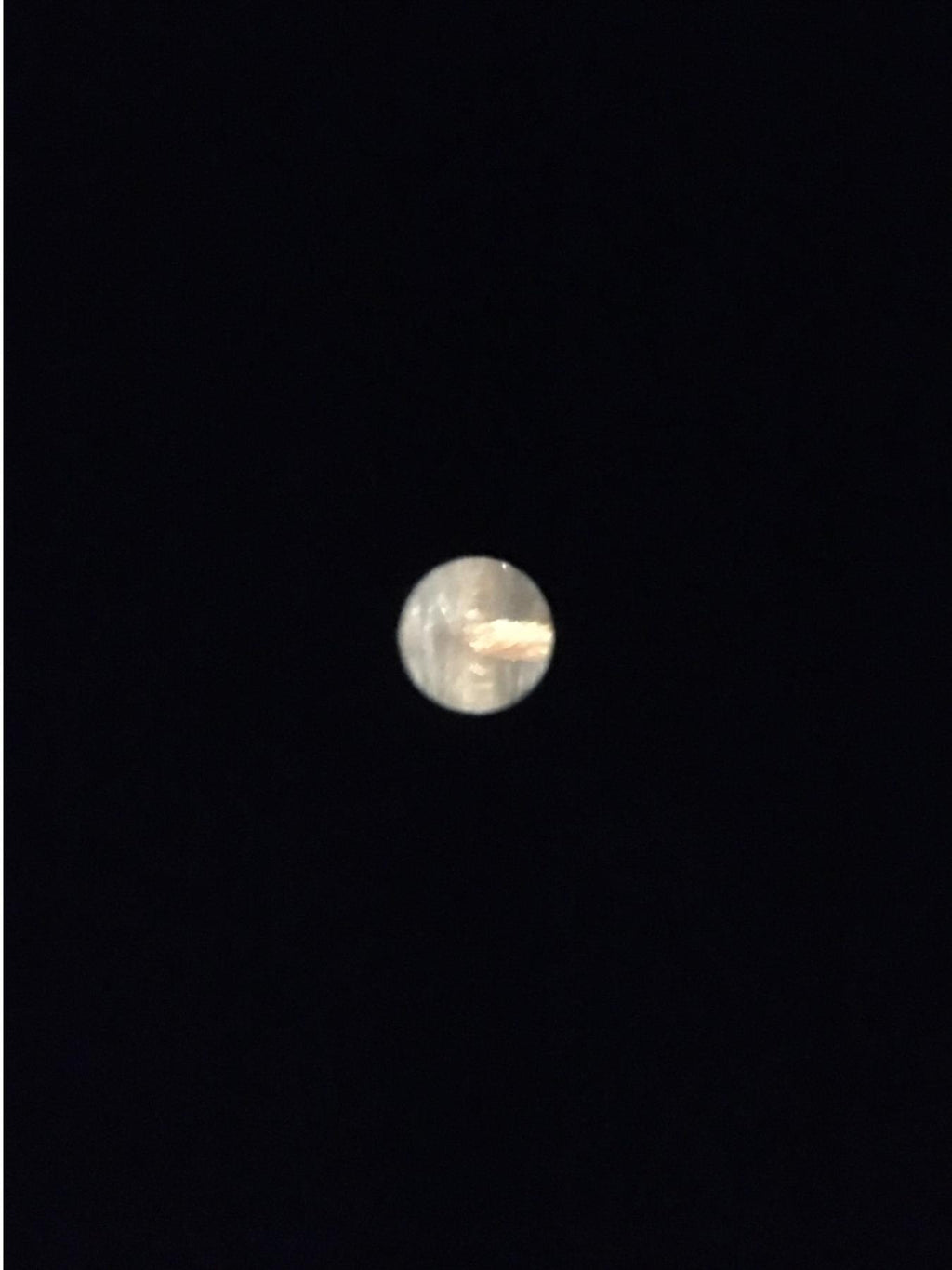 Richard Wolf 8672.31, 2.7mm, 5° PANOVIEW Plus Arthroscope
