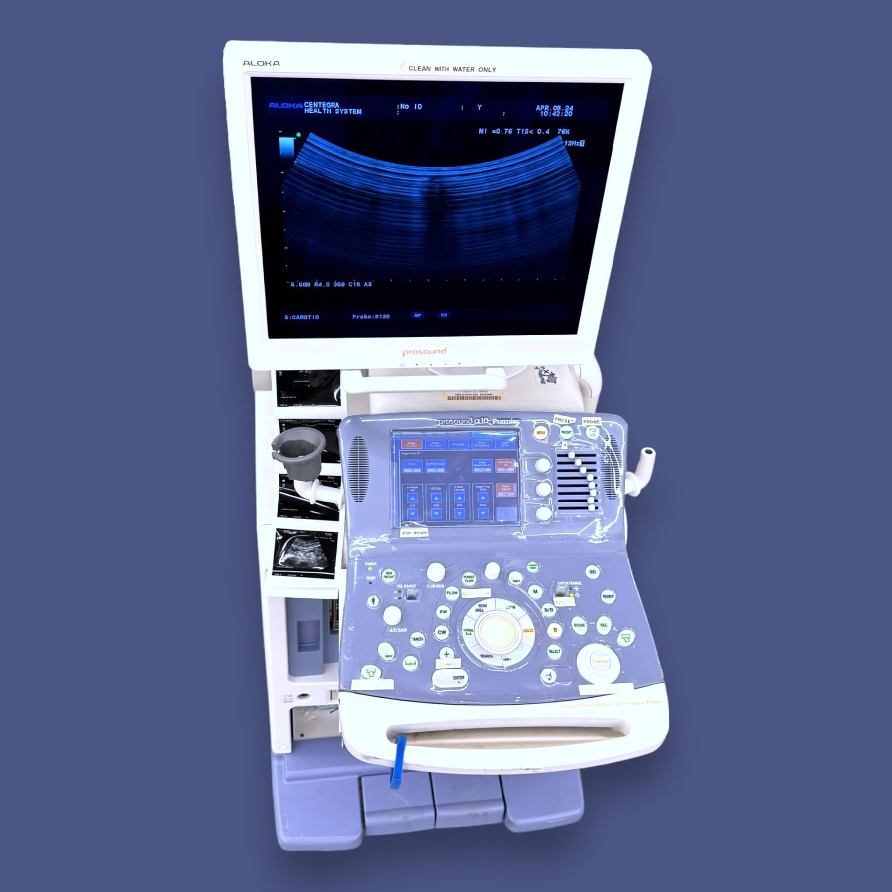 Hitachi Aloka SSD- a10 Prosound Ultrasound System w/ Aloka 9130 Probe
