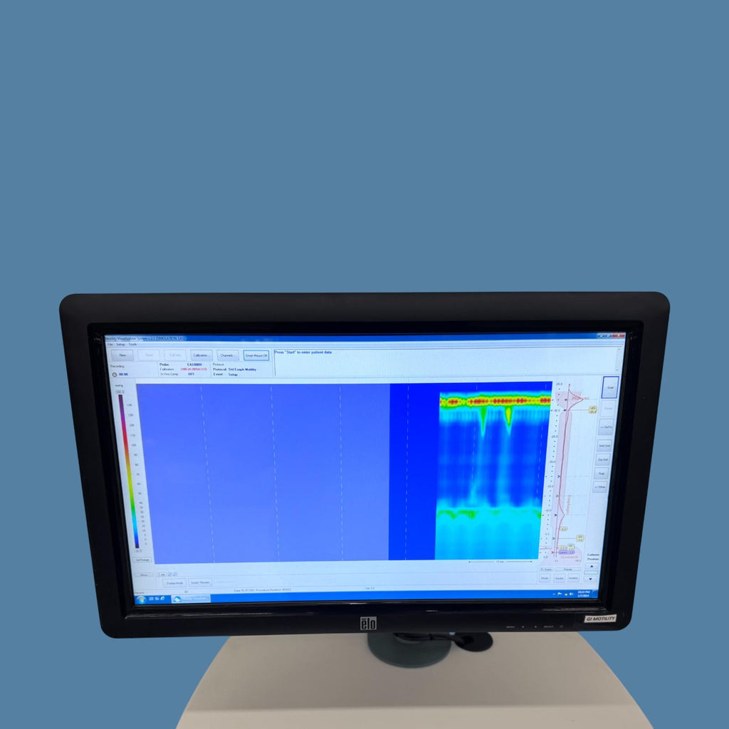 Given Imaging Glen Imaging ManoScan System