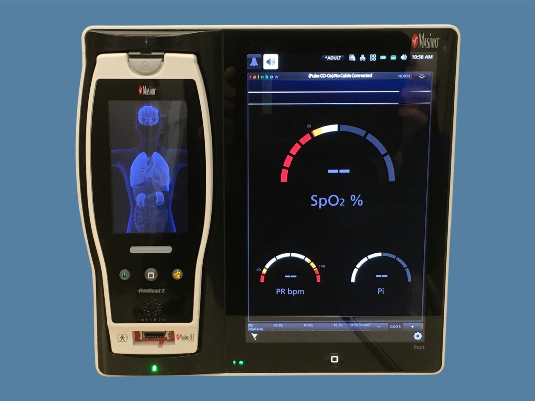 Masimo RDS7A Root Patient Monitor w/ Radical-7 Handheld Pulse Oximeter