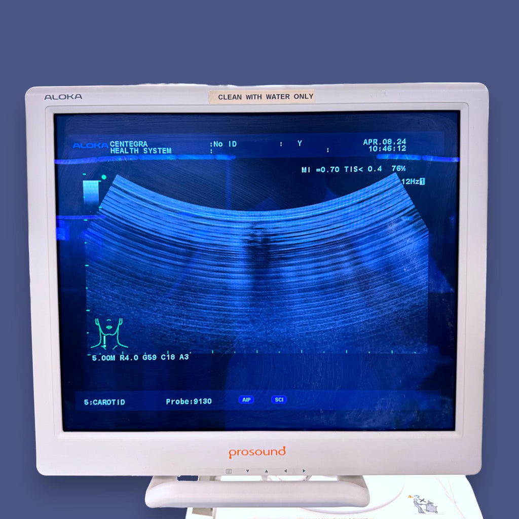 Hitachi Aloka SSD- a10 Prosound Ultrasound System w/ Aloka 9130 Probe