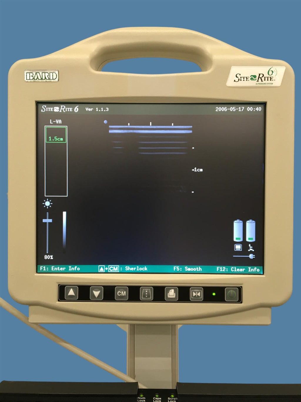 Bard Site-Rite 6 Ultrasound System 9770066 w/ L-VA Linear Vascular Access Probe