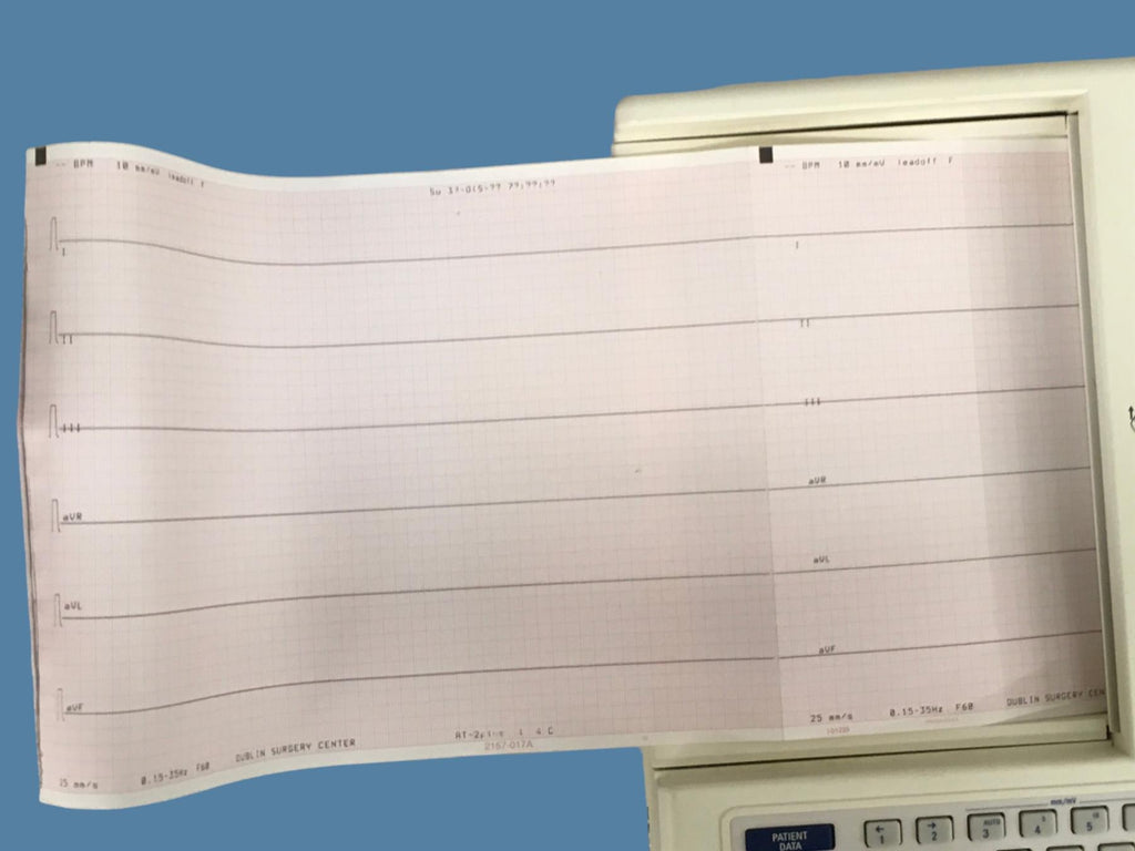 Welch Allyn Schiller AT-2 Plus EKG / ECG Resting Electrocardiograph Console