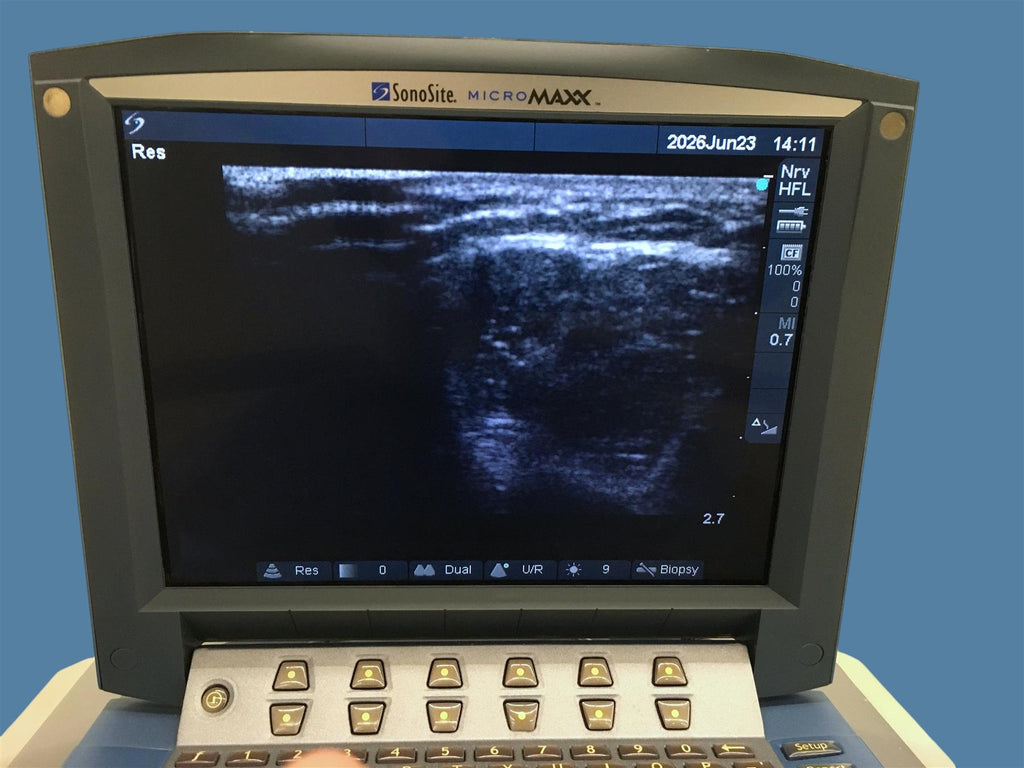 FujiFilm SonoSite MicroMaxx Ultrasound System w/ HFL38/13-6 Probe & Sony Printer