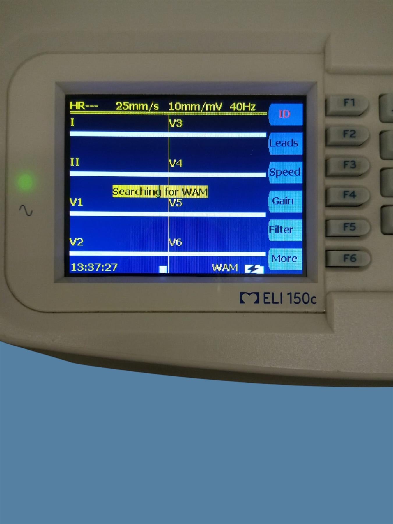 Mortara ELI 150c Interpretive ECG/EKG w/ Wireless Acquisition Module/Leads/Cart