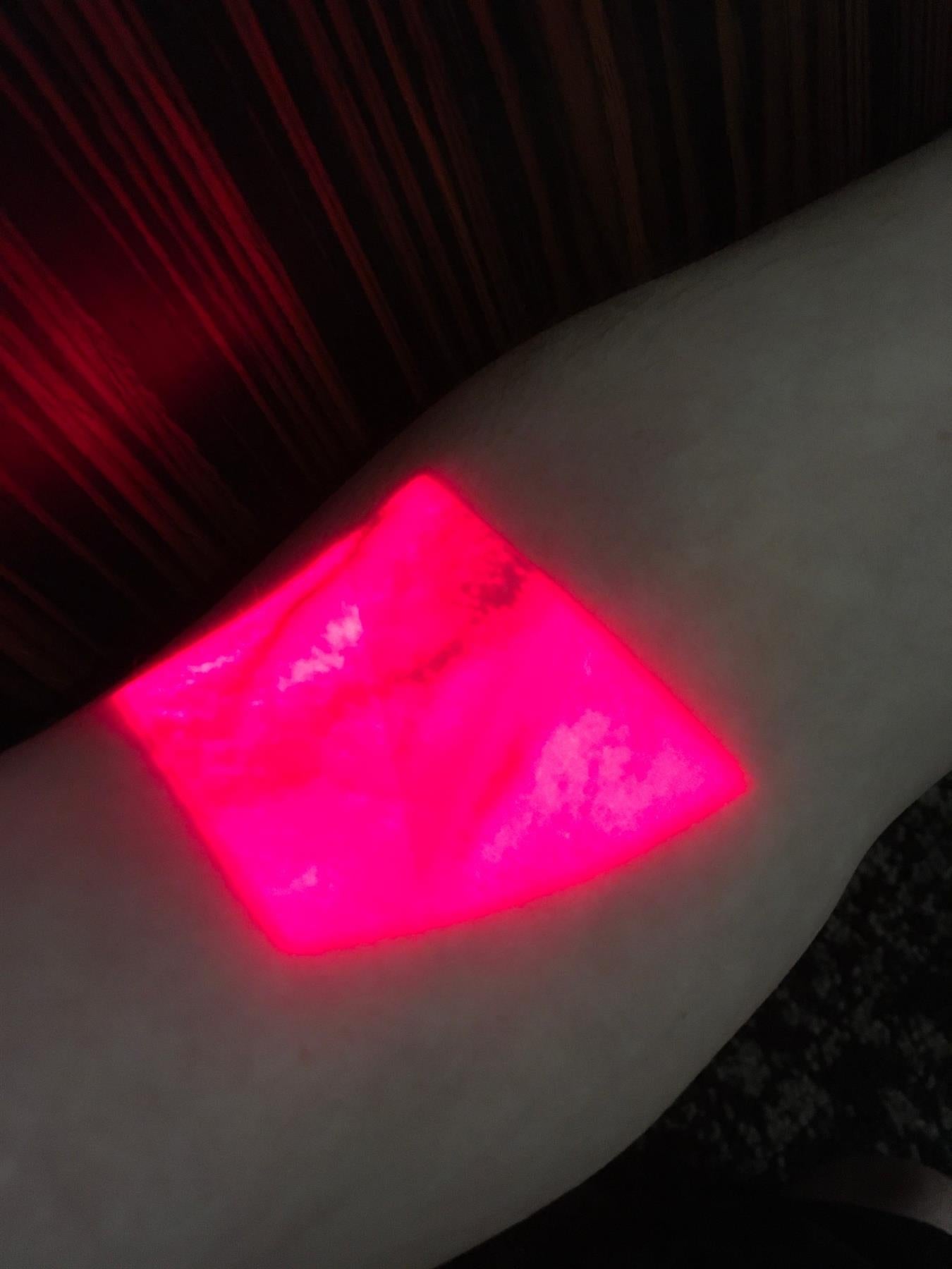 AccuVein AV300 Portable Vein Visualization System w/ Charging Dock (Tested)